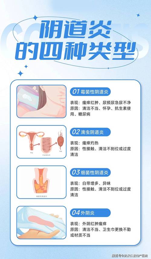 阴道炎反复发作和个人习惯有关吗-示意图