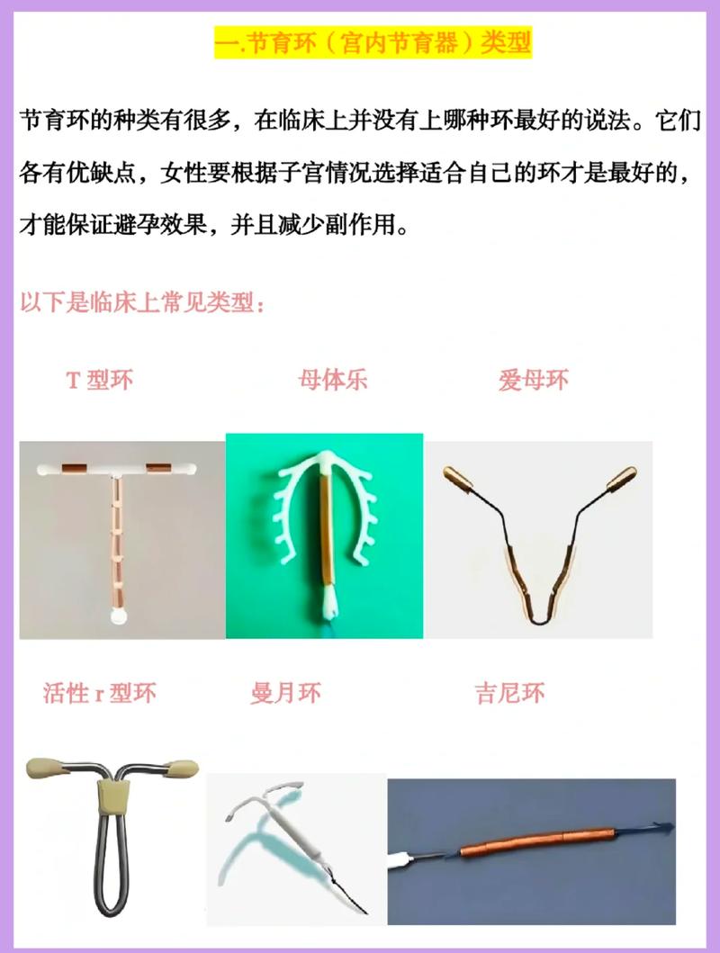 球囊和节育环防粘连哪个好
