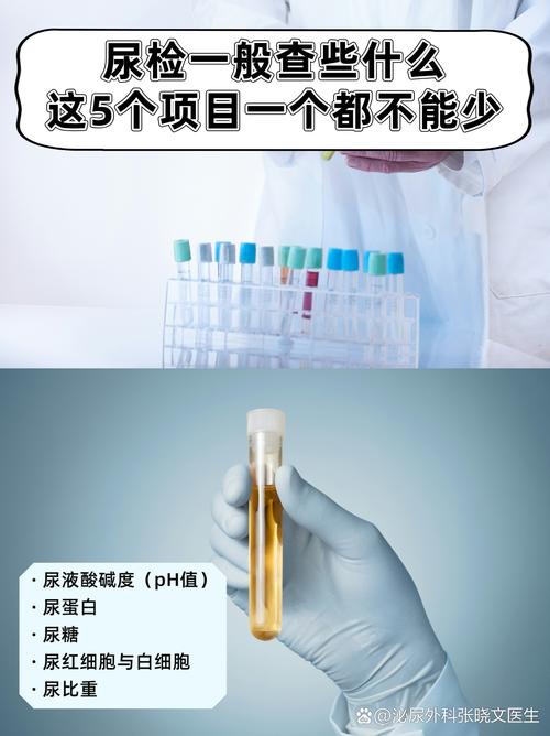 男性尿血要做什么检查