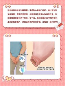 包皮环切后恢复期该注意哪些细节-两性知识丨两性健康--你想了解的我都知道