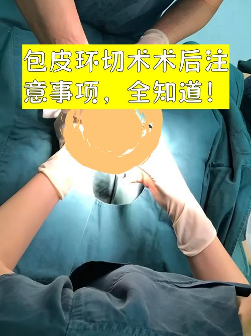 包皮环切后恢复期该注意哪些细节-相关配图