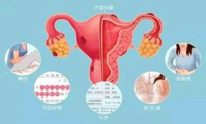 性交疼痛和内异症有关吗-两性知识丨两性健康--你想了解的我都知道