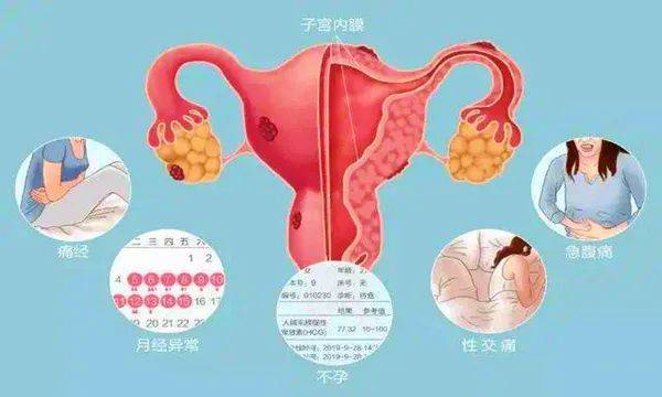 性交疼痛和内异症有关吗