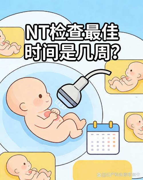 NT超声检查的最佳孕周是几周