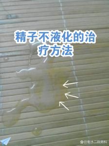 精液不液化要怎么治疗-两性知识丨两性健康--你想了解的我都知道