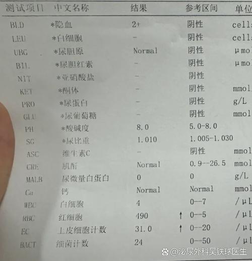 尿路感染老复发该查哪些项