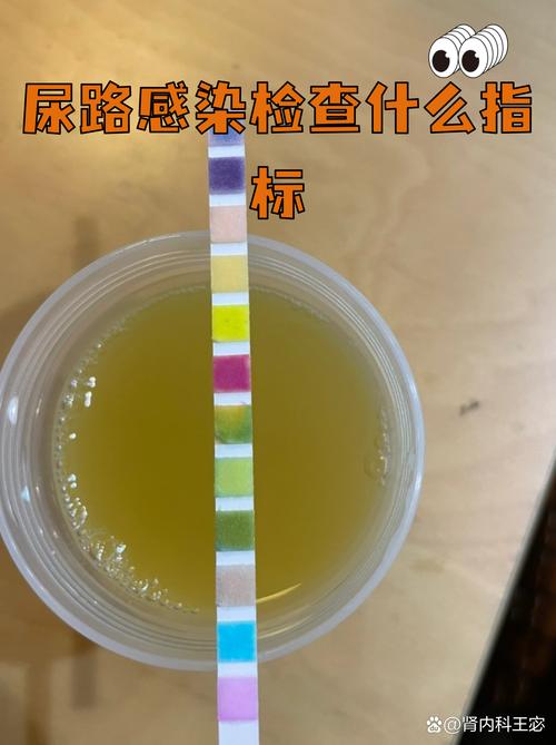 尿路感染老复发该查哪些项