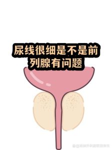 尿线变细是前列腺增生信号吗?一文讲清楚-两性知识丨两性健康--你想了解的我都知道
