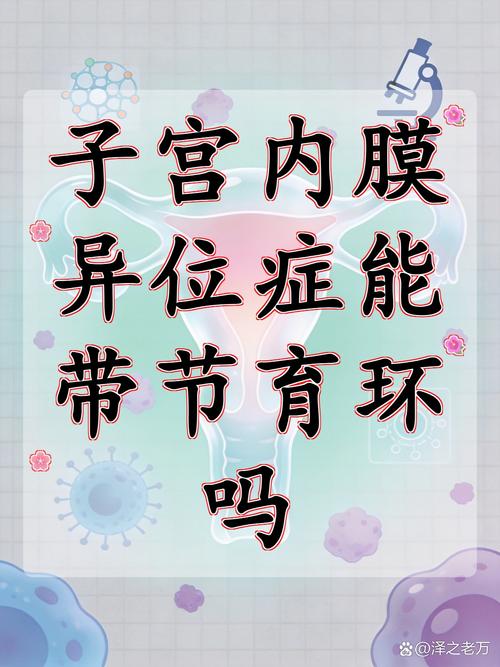 内异症患者还需要避孕吗
