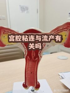 宫腔粘连和反复流产有关吗？一文说清-两性知识丨两性健康--你想了解的我都知道