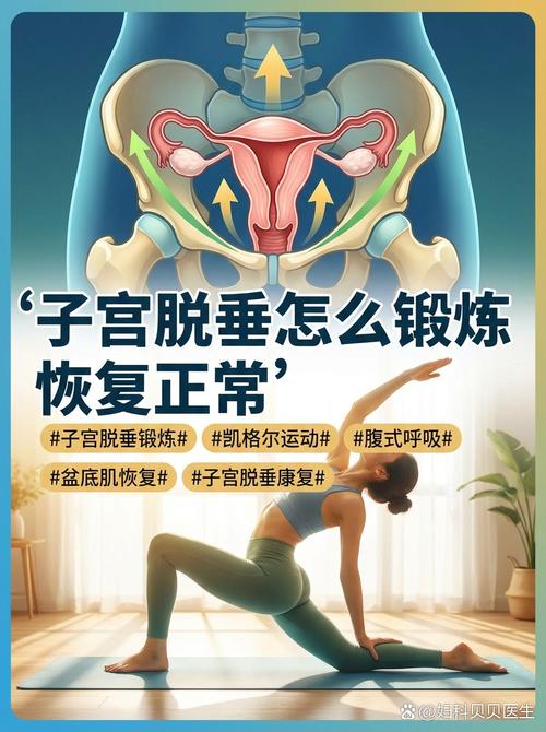 子宫脱垂轻度怎么锻炼