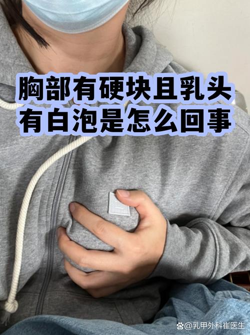 乳房摸到硬块要紧吗