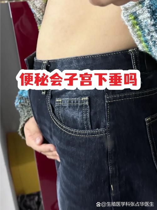 排便用力会让子宫下垂吗
