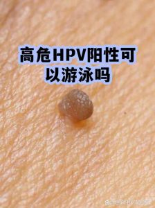 HPV阳性期间能游泳吗?一文给你讲清楚!-两性知识丨两性健康--你想了解的我都知道