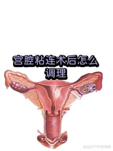 宫腔镜分离术后怎么促进内膜生长-两性知识丨两性健康--你想了解的我都知道