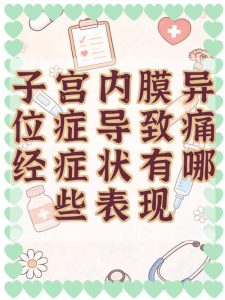 痛经逐月加重,很可能是子宫内膜异位症在报警-两性知识丨两性健康--你想了解的我都知道