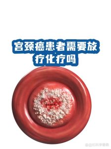 宫颈病变治疗要住院吗？一文说清别慌-两性知识丨两性健康--你想了解的我都知道