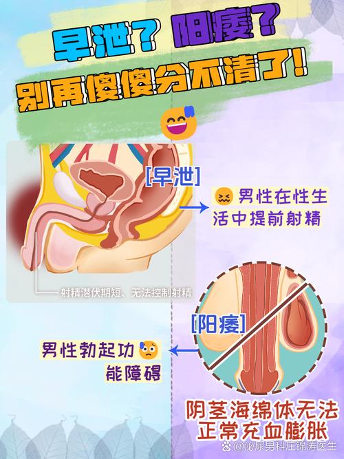 网络男科科普哪些说法不可信