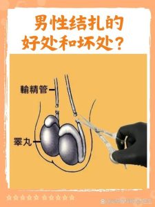 输精管结扎的永久性，其实没你想的那么绝对-两性知识丨两性健康--你想了解的我都知道