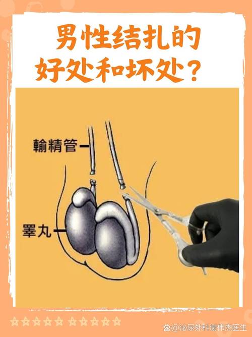 输精管结扎是不是永久性的-示意图