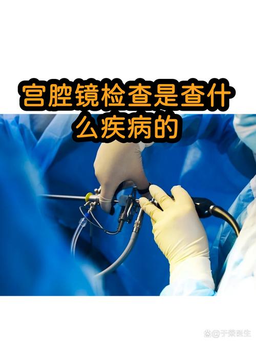 痛经查不出原因要做宫腔镜吗