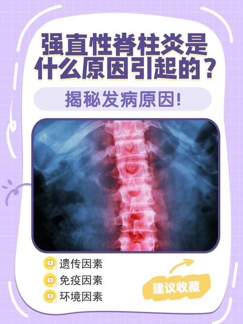 性欲低和强直性脊柱炎有关吗