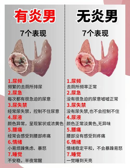 网上男性健康科普该怎么辨别真假