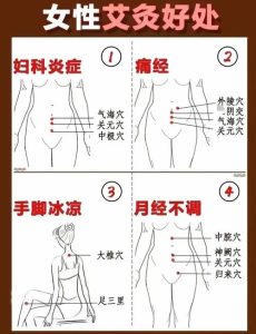 痛经能艾灸调理吗?一文带你搞懂!-两性知识丨两性健康--你想了解的我都知道