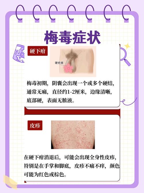 性欲低和梅毒病史有关吗