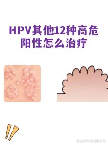 性欲低和HPV感染焦虑有关吗?一文说清两者关系!-两性知识丨两性健康--你想了解的我都知道