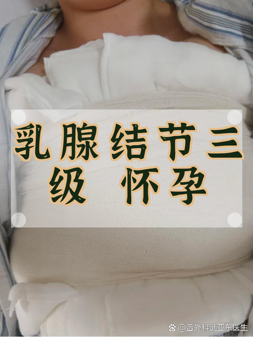 乳腺结节影响怀孕吗