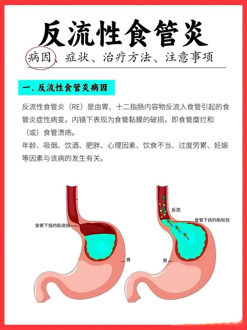 性欲低和胃食管反流有关吗