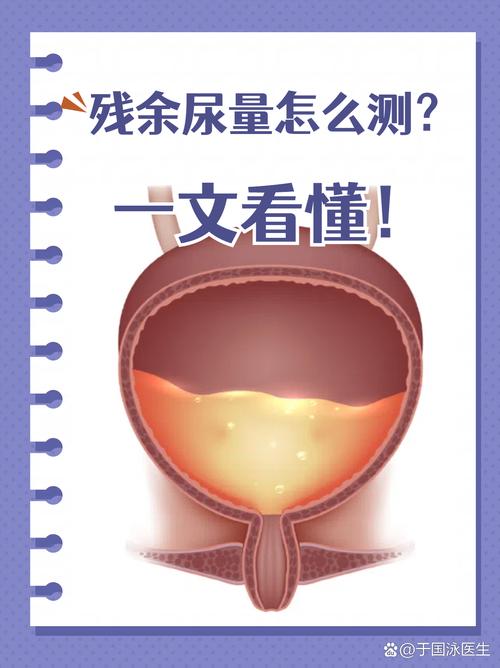尿线变细要不要查残余尿-示意图