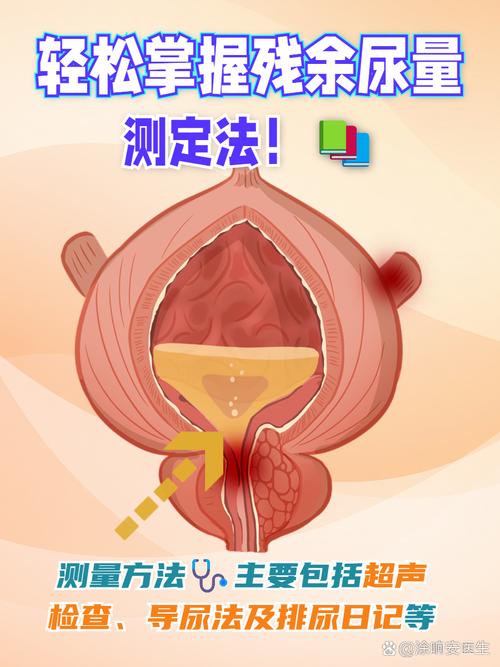 尿线变细要不要查残余尿-相关配图