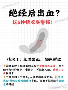 绝经后又出血要紧吗?别慌,先弄清这几点-两性知识丨两性健康--你想了解的我都知道