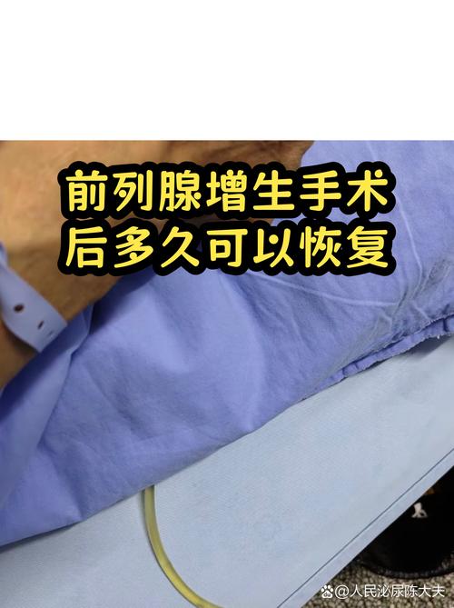 前列腺增生手术要住院几天