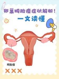 性欲低和卵巢畸胎瘤有关吗?一文说清两者关系!-两性知识丨两性健康--你想了解的我都知道