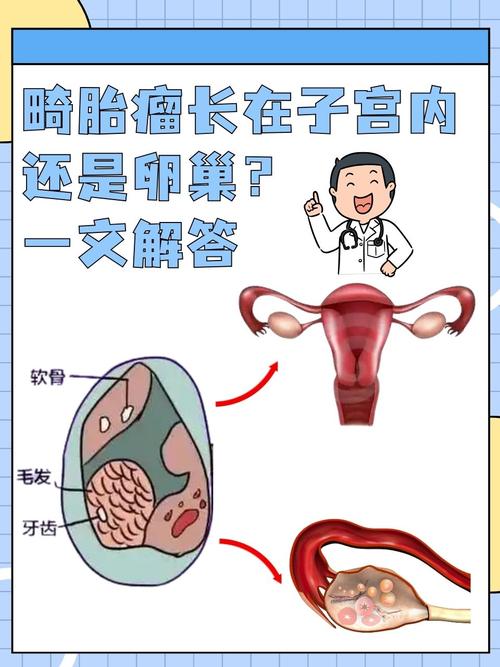性欲低和卵巢畸胎瘤有关吗