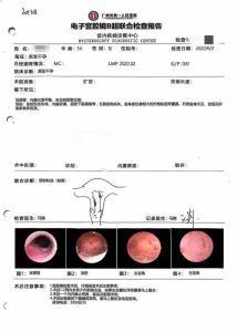 B超查宫腔粘连有局限,这一步更靠谱-两性知识丨两性健康--你想了解的我都知道