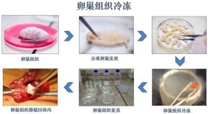 冻存卵巢组织要符合什么条件?这6条门槛先看清-两性知识丨两性健康--你想了解的我都知道