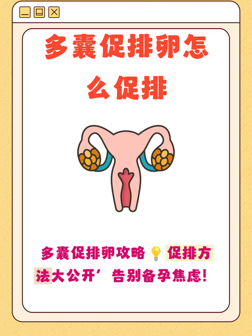 多囊不排卵怎么促排