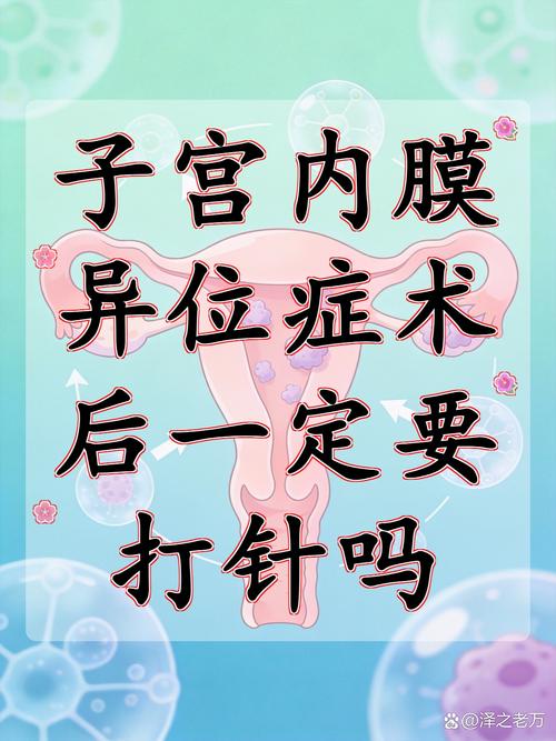 内异症术后打针是为了防复发吗