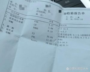补睾酮前该查什么:先把这几张单子开明白-两性知识丨两性健康--你想了解的我都知道