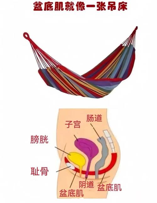 盆底肌紧张会引发性交痛吗