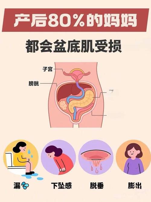 盆底肌紧张会引发性交痛吗