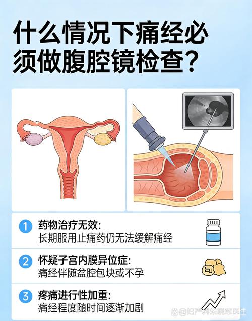 痛经需要做腹腔镜吗