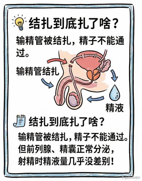 结扎后精液会变少吗