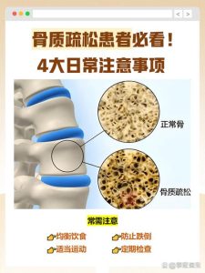 绝经后骨质疏松怎么防-两性知识丨两性健康--你想了解的我都知道