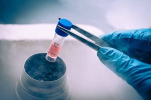 放化疗期间还能取卵冻存吗?-两性知识丨两性健康--你想了解的我都知道