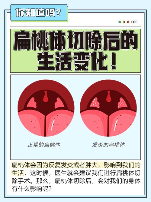 性欲低和扁桃体切除后有关吗-相关配图